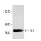 ALB/Albumin Antibody (AL-01) - Western Blotting - Image 45733 