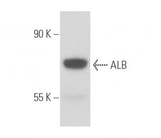 ALB/Albumin Antibody (SAB117) - Western Blotting - Image 15682 