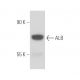 ALB/Albumin Antibody (SAB117) - Western Blotting - Image 15682 