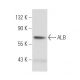 ALB/Albumin Antibody (SAB117) - Western Blotting - Image 45721