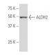 Aldehyde dehydrogenase 2/ALDH2 Antibody (3D12) - Western Blotting - Image 33867