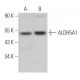 Aldehyde dehydrogenase 5-A1/SSADH/ALDH5A1 Antibody (F-2) - Western Blotting - Image 366830