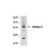 Aldolase A Antibody (1F8) - Western Blotting - Image 21734 