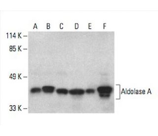 Aldolase A Antibody (C-10) - Western Blotting - Image 393575