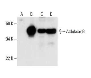 Aldolase B Antibody (C-11) - Western Blotting - Image 294480The Double Nickase Plasmid features a U6 promoter for sgRNA expression, a 20 nt targeting sequence, and a gRNA scaffold to guide Cas9n. It includes a CBh promoter for Cas9n (D10A) and puromycin resistance, GFP for transfection verification, and nuclear localization signals (NLS). The 2A peptide allows co-expression of Cas9n and Puro from a single promoter, enabling precise genome editing with reduced off-target effects.