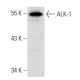 ALK-1 Antibody (RM0015-1B03) - Western Blotting - Image 34831