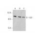 ALK Antibody (ALK1) - Western Blotting - Image 353287 