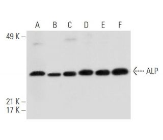 ALP Antibody (B-10) - Western Blotting - Image 312796