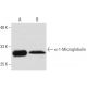 α-1-Microglobulin Antibody (10A12) - Western Blotting - Image 62784