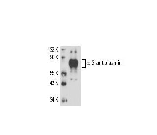 &alpha;-2 antiplasmin Antibody (MAP25C3) - Western Blotting - Image 17189 