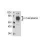 α-2 antiplasmin Antibody (MAP25C3) - Western Blotting - Image 17189 