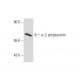 α-2 antiplasmin Antibody (SJ-19) - Western Blotting - Image 61812 