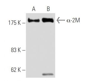 &alpha;-2M Antibody (3D1) - Western Blotting - Image 62793