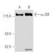 α-2M Antibody (3D1) - Western Blotting - Image 62793
