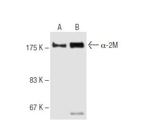 &alpha;-2M Antibody (9A3) - Western Blotting - Image 62792