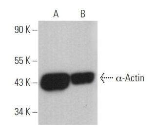 &alpha;-Actin Antibody (0.N.5) - Western Blotting - Image 360930 