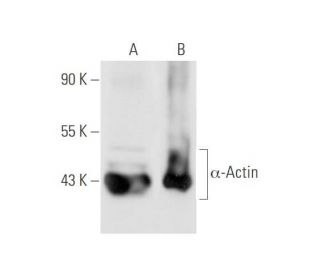&alpha;-Actin Antibody (5C5) - Western Blotting - Image 57955 