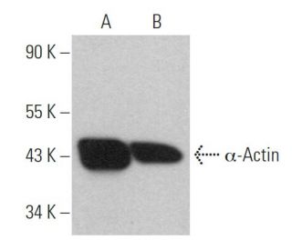 &alpha;-Actin Antibody (alpha-SM1) - Western Blotting - Image 360929 