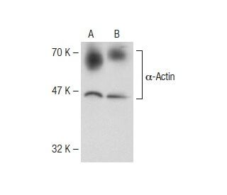 &alpha;-Actin Antibody (Alpha Sr-1) - Western Blotting - Image 148670 