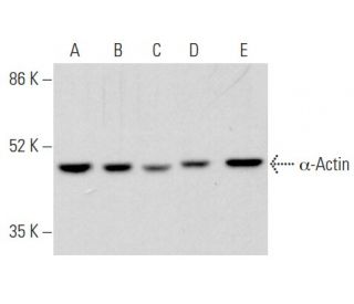 &alpha;-Actin Antibody (SPM332) - Western Blotting - Image 354883 