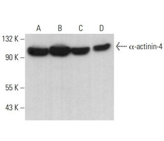&alpha;-actinin-4 Antibody (A-8) - Western Blotting - Image 380777 