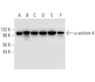 &alpha;-actinin-4 Antibody (B-11) - Western Blotting - Image 300166 