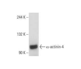 &alpha;-actinin-4 Antibody (LW-M23) - Western Blotting - Image 128804 