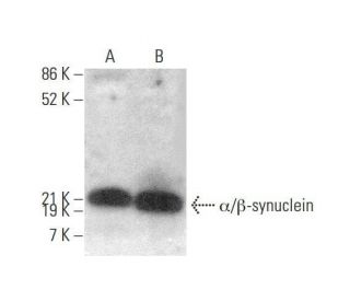 alpha/beta Synuclein Antibody (Syn 202) - Western Blotting - Image 350708 