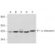 α-chimaerin Antibody (G-8) - Western Blotting - Image 311907 