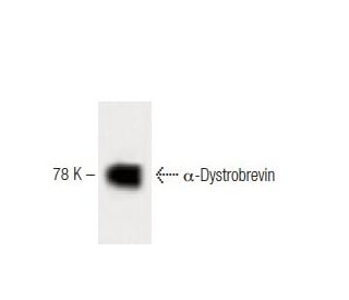 &alpha;-Dystrobrevin Antibody (23) - Western Blotting - Image 60500 