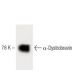 α-Dystrobrevin Antibody (23) - Western Blotting - Image 60500 