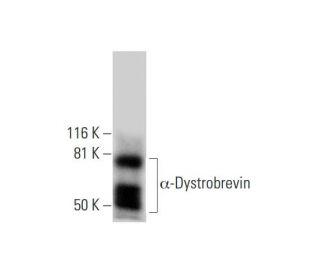 &alpha;-Dystrobrevin Antibody (B-1) - Western Blotting - Image 290805 