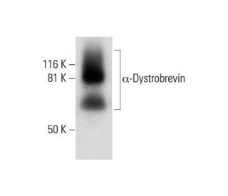 &alpha;-Dystrobrevin Antibody (B-2) - Western Blotting - Image 294838 
