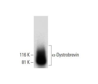 &alpha;-Dystrobrevin Antibody (E-12) - Western Blotting - Image 294837 