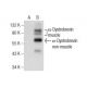 α-Dystrobrevin Antibody (F-6) - Western Blotting - Image 159250