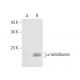 α-lactalbumin Antibody (A-2) - Western Blotting - Image 296918