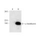 α-lactalbumin Antibody (H-1) - Western Blotting - Image 299208