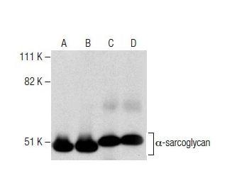 &alpha;-sarcoglycan Antibody (D-7) - Western Blotting - Image 281271 
