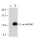 alpha Synuclein Antibody (3G282) - Western Blotting - Image 39339