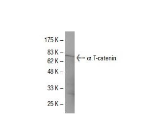 &alpha; T-catenin Antibody (212) - Western Blotting - Image 33444