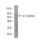 α T-catenin Antibody (212) - Western Blotting - Image 33444