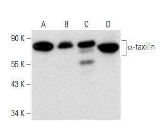 &alpha;-taxilin Antibody (E-2) - Western Blotting - Image 136491 
