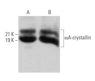 &alpha;A-crystallin Antibody (SUB4) - Western Blotting - Image 373568 
