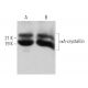 αA-crystallin Antibody (SUB4) - Western Blotting - Image 373568 