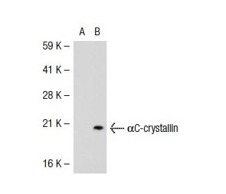 &alpha;C-crystallin Antibody (2H5) - Western Blotting - Image 39364