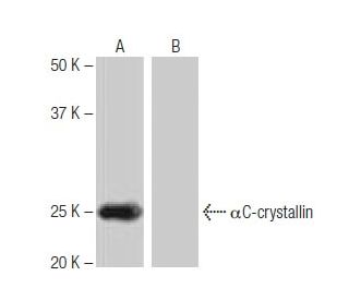 &alpha;C-crystallin Antibody (PL-A11) - Western Blotting - Image 64820