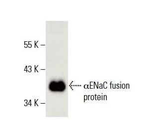 &alpha;ENaC Antibody (H-6) - Western Blotting - Image 396357 