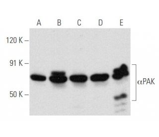 &alpha;PAK Antibody (A-6) - Western Blotting - Image 354845 