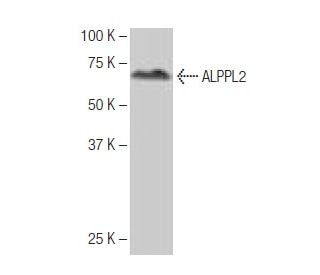 ALPPL2 Antibody (9-YD35) - Western Blotting - Image 64839