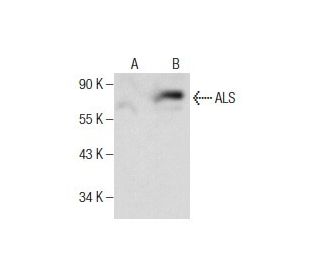 ALS Antibody (E-2) - Western Blotting - Image 281798